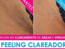 Removedor de Manchas da Pele